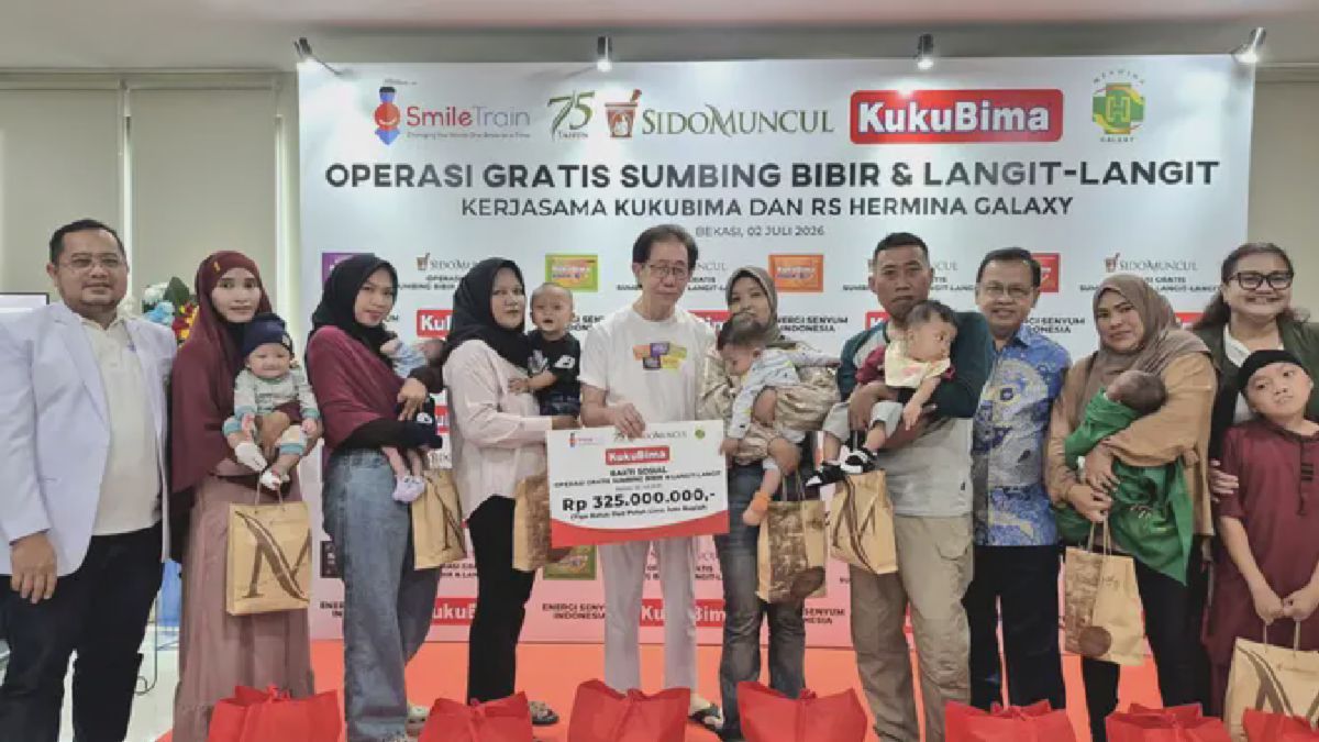 Sido Muncul Salurkan Bantuan Rp325 Juta untuk Operasi Sumbing Gratis